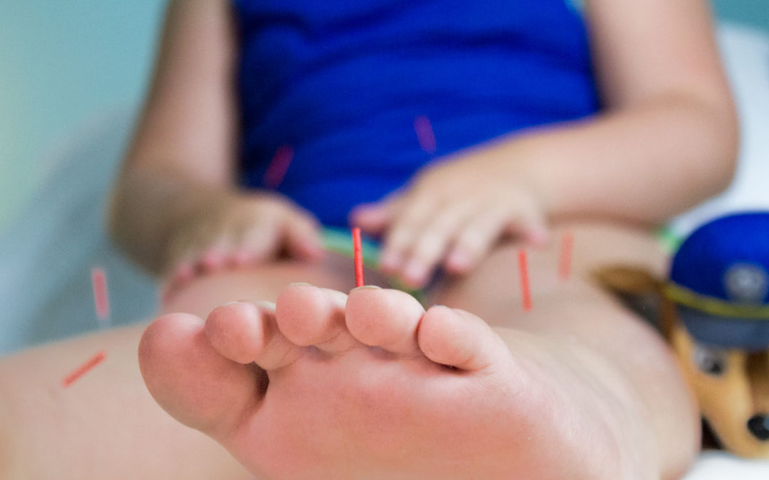 Treating Childhood Eczema with Acupuncture and Herbs
