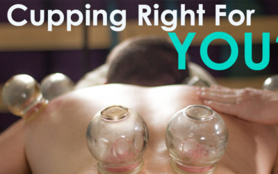 Is Cupping Right For You?